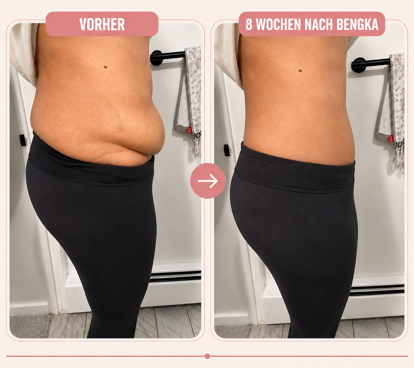 Limova Forma™